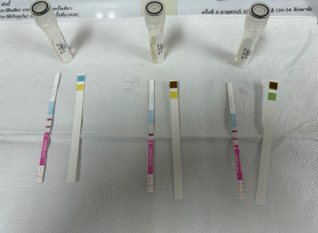 รพ.สต.บ้านสันป่าไร่ ทดสอบความชำนาญทางห้องปฏิบัติการหน่วยบริการปฐมภูมิ