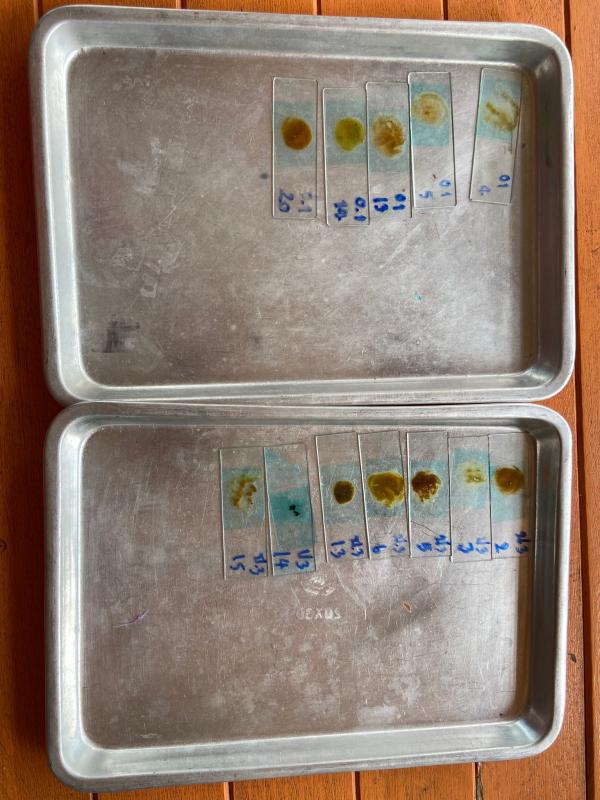 16-18866 จนท.รพ.สต.บ้านสันป่าไร่ ให้ความรู้เกี่ยวกับโรคหนอนพยาธิและตรวจอุจจาระเพื่อค้นหาไข่พยาธิในพื้นที่โครงการพระราชดำริโรงเรียนจาตุรจินดา จำนวน 112 คนพบไข่พยาธิไส้เดือน 2 คน แส้ม้า 4 คนและโรงเรียนบ้านสี่หลัง จำนวน 31 คน พบไข่พยาธิไส้เดือน 1 คน